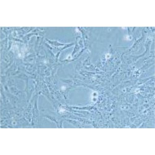 Human Lens Epithelial Cell Line, #HEL-B3