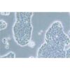 Human Breast Ductal Cancer Cell Line, #UACC-812