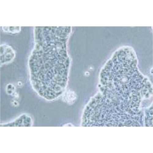 Human Breast Ductal Cancer Cell Line, #UACC-812