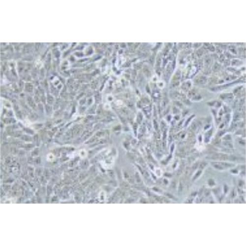 Human Colorectal Adenocarcinoma Cell Line, #SNU-C5