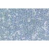 Human Gastric Carcinoma Cell, #SNU-638