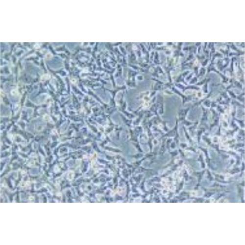 Human Gastric Carcinoma Cell, #SNU-638