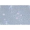 Human Gastric Carcinoma Cell, #SNU-216