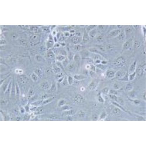 Human Gastric Carcinoma Cell, #SNU-216