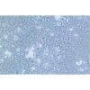 Human Colonic Adenocarcinoma Cell Line, #SNU-81