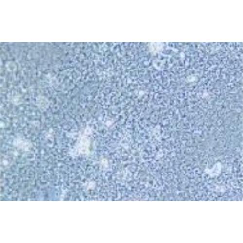 Human Colonic Adenocarcinoma Cell Line, #SNU-81