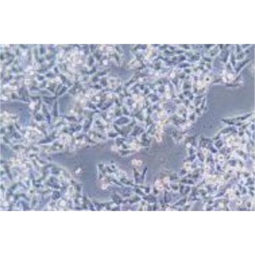 Human Colorectal Adenocarcinoma Cell Line, #SK-CO-1