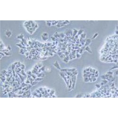 Human Lung Cancer Cell Line, #NCI-H69AR