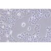 Human Non-Small-Cell Lung Cancer Cell Line, #NCI-H322