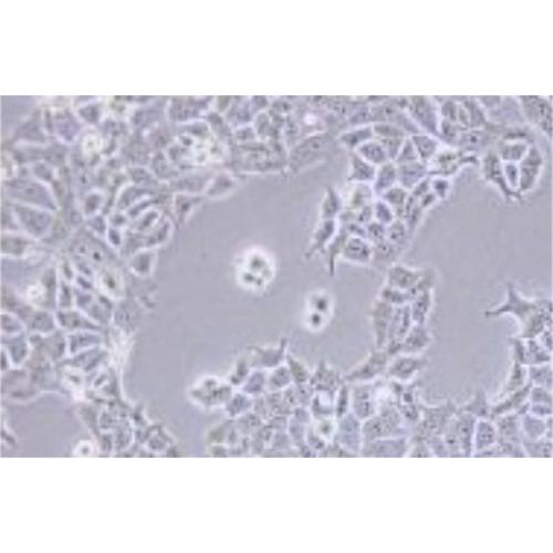 Human Non-Small-Cell Lung Cancer Cell Line, #NCI-H322