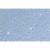 Human Lung Adenocarcinoma Cell Line, #NCI-H441