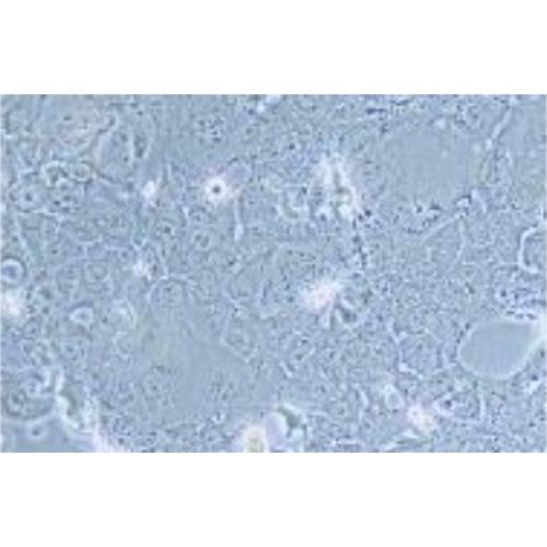 Human Lung Papillary Adenocarcinoma Cell Line, #NCI-H820