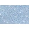 Human Lung Cancer Cell Line, #NCI-H838