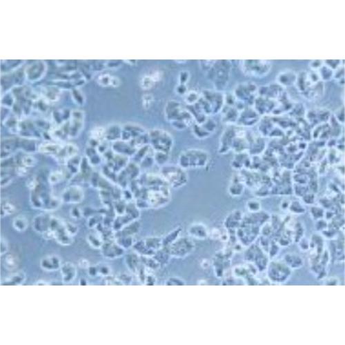 Human Small-Cell Lung Cancer Cell Line, #NCI-H1408