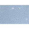 Human Lung Adenocarcinoma Cell Line, #NCI-H1792