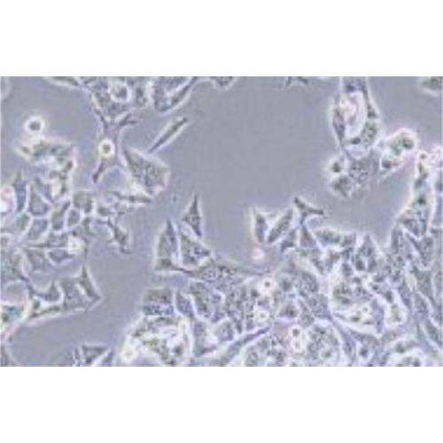 Human Adenocarcinoma Cell Line Of Non-Small-Cell Lung Cancer, #NCI-H1993