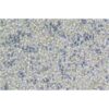 Human Non-Small-Cell Lung Cancer Cell Line, #NCI-H2122