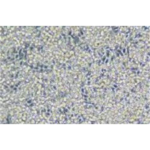 Human Non-Small-Cell Lung Cancer Cell Line, #NCI-H2122