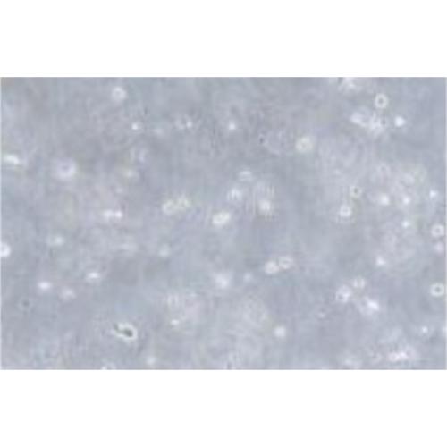 Human Acute Myeloid Leukemia Cell Line, #NOMO1