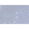 Human Ovarian Epithelial Tumor Cell Line, #OAW-28