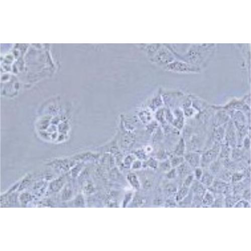 Human Ovarian Epithelial Tumor Cell Line, #OAW-28