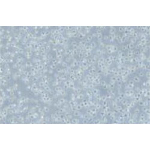 Human B-Cell Lymphoma Cell Line, #OCI-LY1