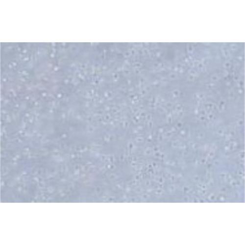 Human B-Cell Lymphoma Cell Line, #OCI-LY19