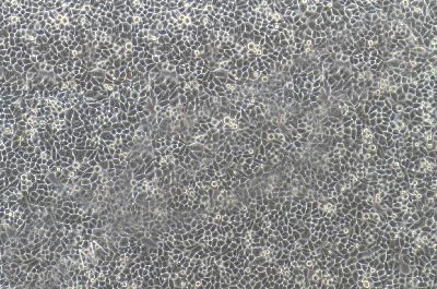 Luciferase Labeling In Human Cervical Cancer Cell Line, #HELA+LUC