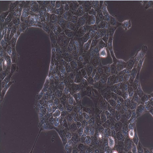 Human Papillary Thyroid Carcinoma Cell Lines, #TPC-1