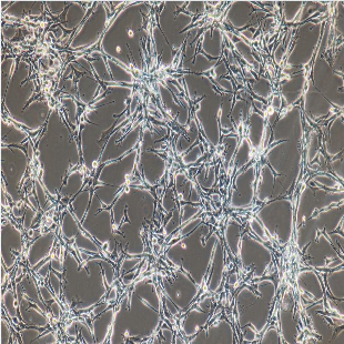 Astroglilastoma Of The Human Brain, #U118MG