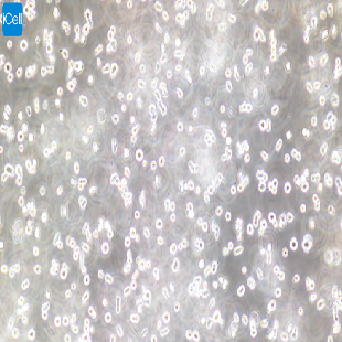 Human Lymphoblastoid Cell Line, #T2 (174XCEM.T2 )