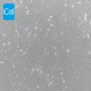 Human Rhabdomyoma Tumor Cell Line, #A673