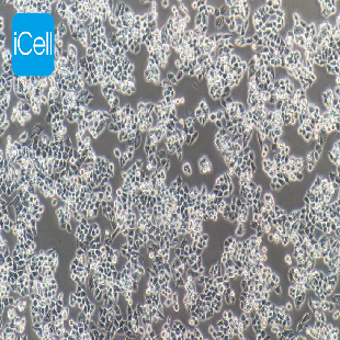 Human Ovarian Cancer Cell Line, #A2780