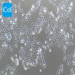 Human Renal Cell Adenocarcinoma Cell Line, #ACHN