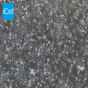 Human Metastasized Pancreatic Adenocarcinoma Cell Line, #ASPC-1