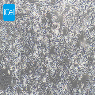 Human Liver Cancer Cell Line, #BEL-7402