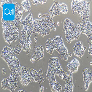 Human Breast Ductal Cancer Cell Line, #BT-474