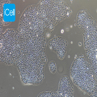 Human In Situ Pancreatic Adenocarcinoma Cell Line, #BXPC-3