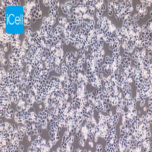 Human Cervical Carcinoma Cell, #C-33A