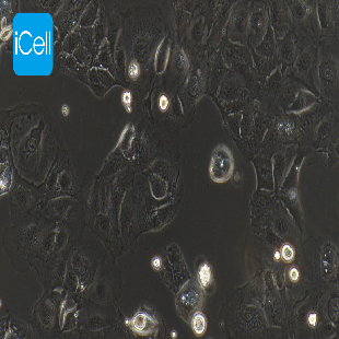 Human Colonic Adenocarcinoma Cell Line, #CACO-2
