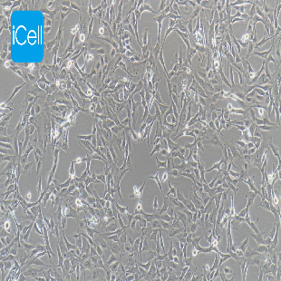 Human Lung Cancer Cell Line, #CALU-1
