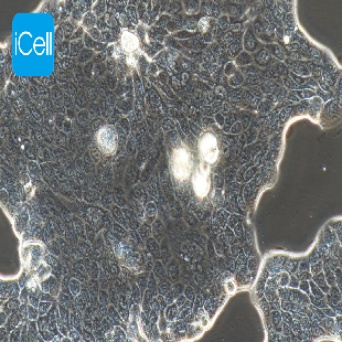 Human Lung Adenocarcinoma Cell Line, #CALU-3