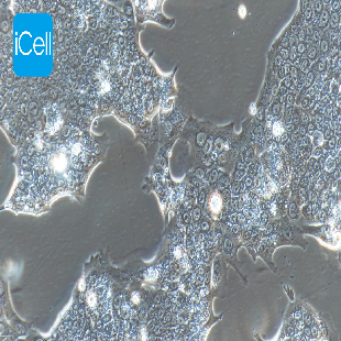 Human Pancreatic Cancer Cell Line, #CAPAN-1