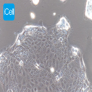 Human Pancreatic Cancer Cell Line, #CAPAN-2