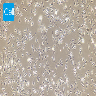 Human Umbilical Vein Cell Line Are Confluent Cell Line, #EA.HY926