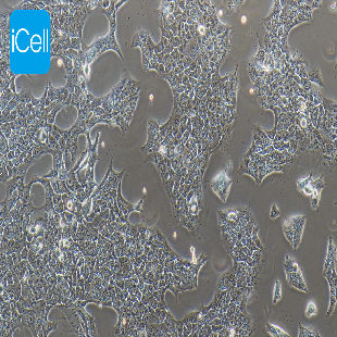 Human Non-Small-Cell Lung Cancer Cell Line, #HCC827