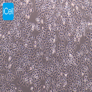 Human Highly Metastatic Hcc Cell Line, #HCC-LM3