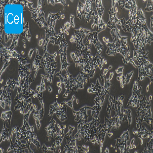 Human Colon Cancer Cell Line, #HCT116