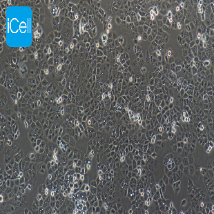 Human Endometrial Adenocarcinoma Cell Line, #HEC-1-A