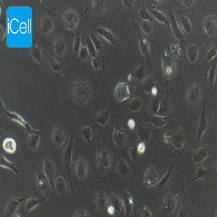 Human Umbilical Vein Endothelial Cell Line (Immortalized) , #HUVEC
